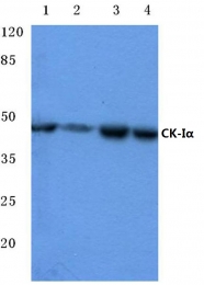 AP06696PU-N - CSNK1A1