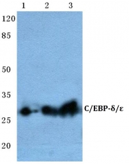 AP06699PU-N - CEBPE