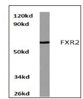 AP06702PU-N - FXR2