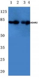 AP06707PU-N - ADARB1 / ADAR2