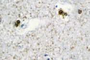 AP06710PU-N - SP3/4