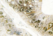 AP06719PU-N - NCBP1