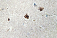 AP06723PU-N - MTA1