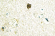 AP06725PU-N - SMAD4