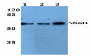 AP06725PU-N - SMAD4