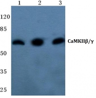 AP06726PU-N - CAMK2B