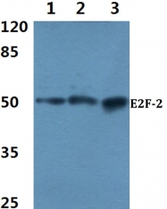 AP06731PU-N - E2F2