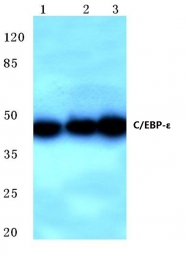 AP06738PU-N - CEBPE