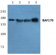 AP06744PU-N - SMARCC2 / BAF170