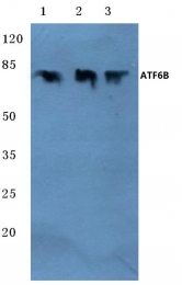 AP06751PU-N - ATF6 beta