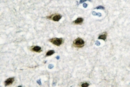 AP06755PU-N - DCP1A