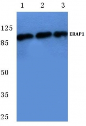 AP06756PU-N - ERAP1 / ARTS1