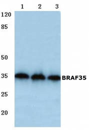 AP06758PU-N - SMARCE1-related protein