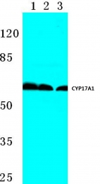 AP06771PU-N - CYP17A1
