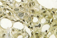 AP06771PU-N - CYP17A1