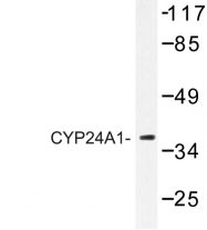 AP06772PU-N - CYP24A1