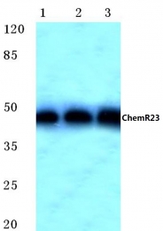 AP06779PU-N - Chemokine receptor-like 1