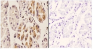 AP06779PU-N - Chemokine receptor-like 1