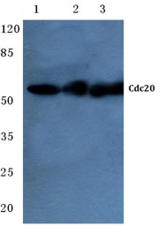 AP06783PU-N - CDC20