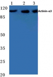 AP06785PU-N - Alpha-actinin-3 / ACTN3