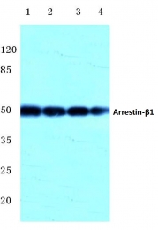 AP06791PU-N - Arrestin beta-1 / ARRB1