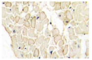 AP06794PU-N - Cadherin-13