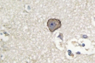AP06795PU-N - Cadherin-15