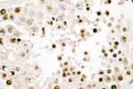 AP06799PU-N - Nibrin