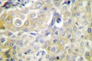 AP06801PU-N - SERPINB5 / Maspin