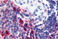 AP07047PU-N - Attractin