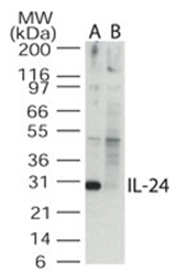 AP07161PU-N - Interleukin-24 / IL24
