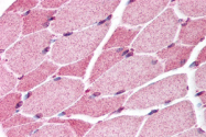 AP07193PU-N - SMAD7
