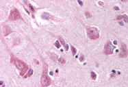 AP07195PU-N - NOXA