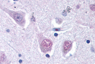 AP07203PU-N - RGS2