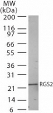 AP07203PU-N - RGS2