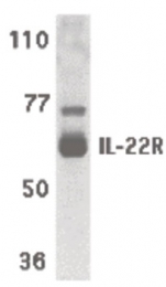 AP07312PU-N - IL22RA1 / IL22R