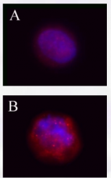 AP07478PU-S - Tuberin / TSC2