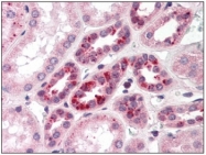 AP07611SU-N - NOTCH2