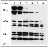 AP07611SU-N - NOTCH2
