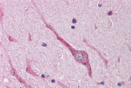 AP07738PU-N - SNAI2 / SLUG