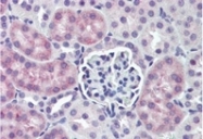 AP07808SU-N - Angiopoietin-1