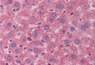 AP07808SU-N - Angiopoietin-1