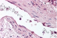 AP07808SU-N - Angiopoietin-1