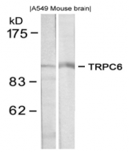 AP08080PU-S - TRPC6 / TRP6