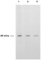 AP08213PU-N - Thymidylate synthase (TS)