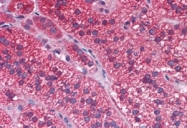 AP08427PU-N - IAP2 / BIRC2
