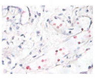 AP08717PU-N - MAP kinase p38 alpha / MAPK14