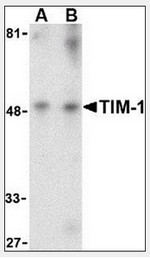 AP08825PU-N - TIMD1 / HAVCR1