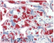 AP09195PU-N - Red Blood Cells