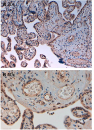 AP09251PU-N - Aurora kinase B